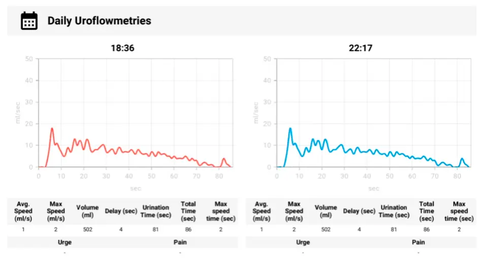 FlowSelfie uroflowmetry: Flow speed chart (ml/s). Qmax, total volume, duration — compared to normal range.